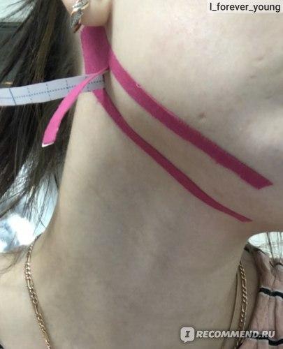 Этап постоперационной реабилитации